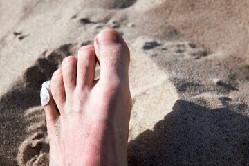 Left male foot with slight sunburn and a wound plaster on the little finger.