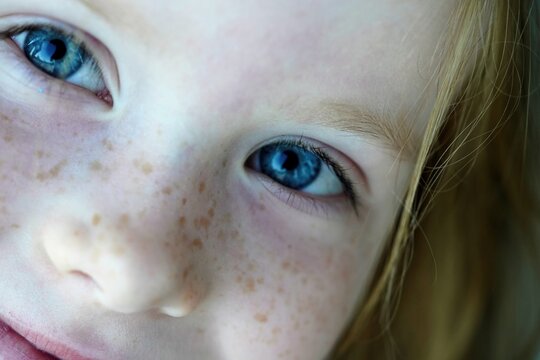 Close Up Of Little Girl Face With Freckles And Bright Blue Eyes 