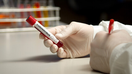 Scientist marking with pen Coronavirus test tube