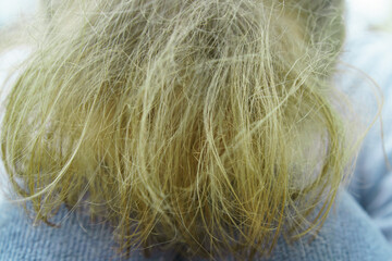 
Part of modern Teen Hairstyle. Youth fashion. The girl putting her hair back in a ponytail. But hair is very dry and unhealthy. Back / rear view.