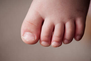 Baby toes closeup. Selective focus. Childhood. Selective focus.