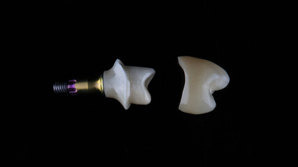 dental crown made of ceramic and orthopedic components, shot from above on a black background