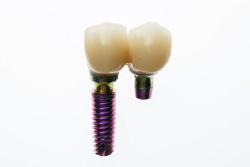 paired two crowns on a replica implant, temporary prosthetics on a white background