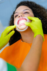 Mixed-race teenage girl with dental cheek retractor in her mouth and dentist's hands checking it