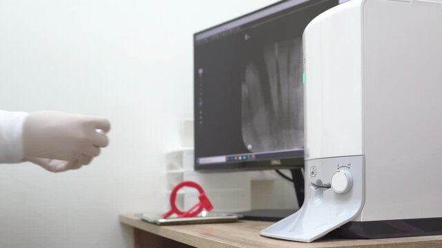 dentist assistant insert tooth x-ray film into the machine to interpret result. dentistry and healthcare concept