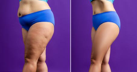 Woman's body before and after weight loss on purple background - obrazy, fototapety, plakaty