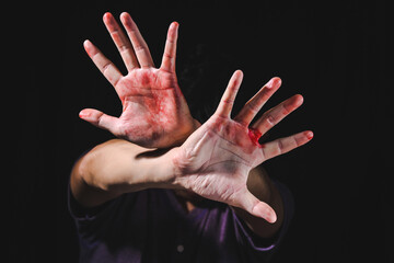 Hand defending victim of human trafficking for stop violence and abuse human trafficking harassment against rape