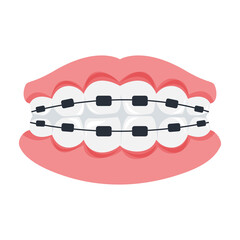 Teeth Braces Illustration on White Background.