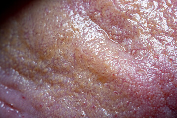 Fototapeta premium Close-up of part of the male tongue in soft focus at high magnification under the microscope. Clearly visible surface texture of the tongue
