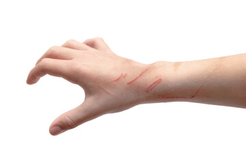 Child's hand backside scratched by cat on the wrist. Isolated on white background.