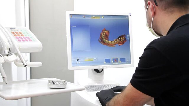 Dental scanning for treatment. 3D graphics of scanned teeth on the monitor. Dentist doctor examines the patient's teeth in the monitor. 