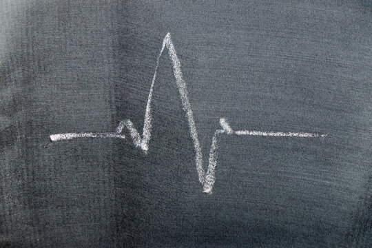 White color chalk hand drawing in pulse rate shape on black board background - Powered by Adobe
