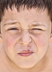 Naklejka premium Young Boy With A Herpes On His Lip