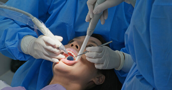 Woman undergo dental scaling treatment