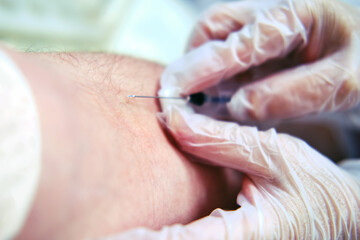 A hand with a syringe pierces the vein of a patient with covid coronavirus with a needle