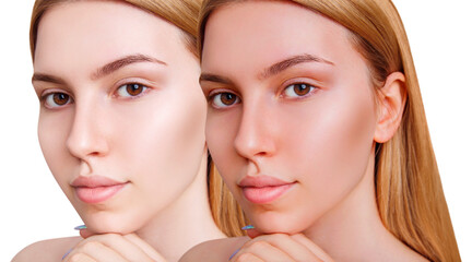 Face of young woman before and after sunburn.