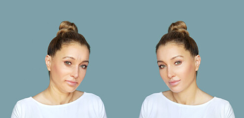 Effects of ageing,Frown/scowl lines ,Nasolabial folds,Neck ,Under eye circles,neck lines.	Plastic...