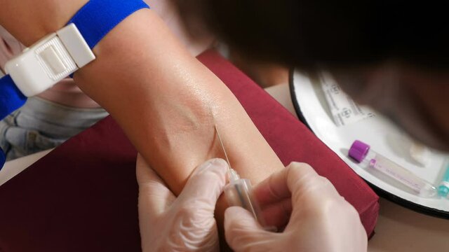 Healthcare concept. Laboratory in clinic. Female lab assistant taking venous blood for test. HIV Hepatitis Test. 4 k footage