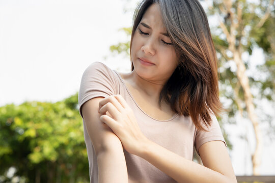 Asian woman scratching her arm skin; concept of dry skin, allergic skin inflammation, body care, fungus inflammation, dermatology disease, eczema, rash, skin care; young adult asian woman model