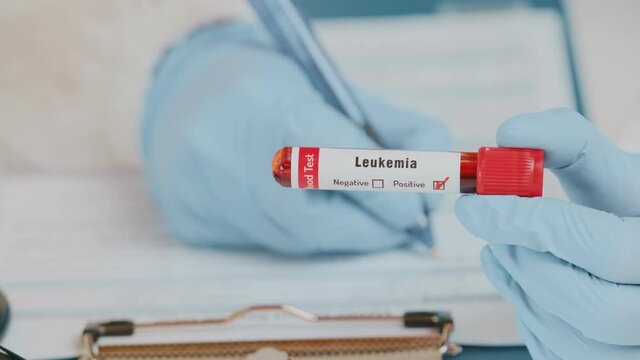 Doctor or laboratory technician holds in one hand laboratory blood sample tube for leukemia cells test, other handwriting down results to patients medical record. Laboratory medical diagnostics