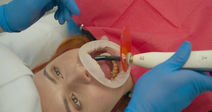 Dental curing light used for teeth treatment, modern equipment, process closeup