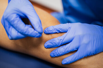 From above of crop faceless sports medicine doctor in sterile gloves inserting thin needle in leg of unrecognizable male patient in underwear lying on examination couch during acupuncture process