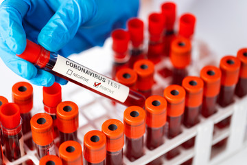 Fototapeta premium Technician holding blood tube test in the research laboratory