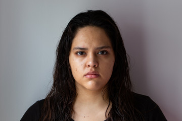 Hispanic white woman with acne, imperfections and pimples on a white background. White teenager with black eyes and black hair