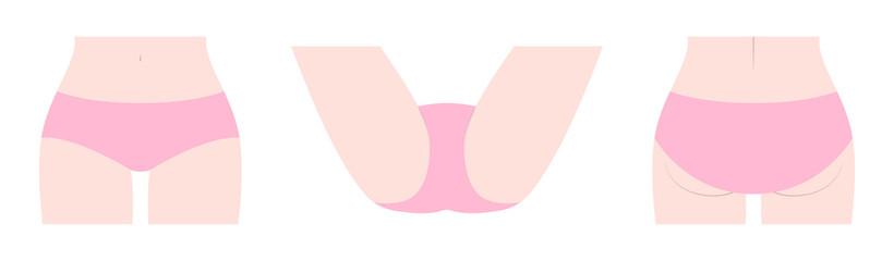 デリケートゾーン　女性　インナー着用