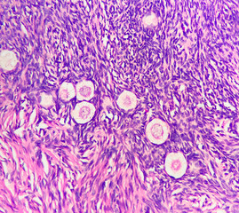 Photo of normal ovary, showing ovarian stroma, primordial follicles and oocytes, photo under microscope, magnification 400x