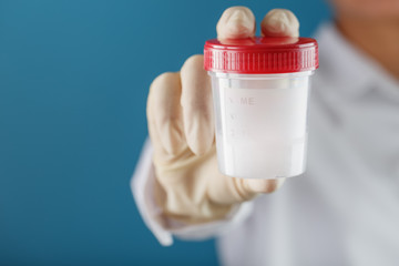 A doctor's gloved hand holding a bottle of a container with a sperm sample for medical analysis.