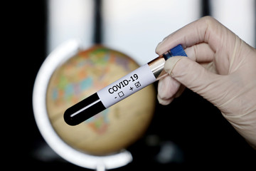 Test tube with covid-19 blood sample in female hands on globe background. Doctor or scientist with positive coronavirus test, pandemic in world	