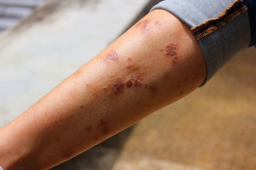 close up of a hand holding a gun