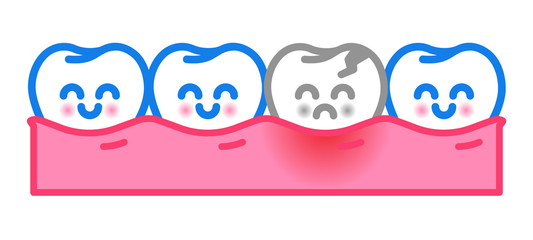 Vector cute healthy cartoon tooth and tooth decay isolated on white. Toothache and gingival inflammation