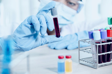 doctor's hand holding a sample blood tube for analysis and test virus disease in the laboratory, This research is plasma biomedicine for diagnostic medical healthcare