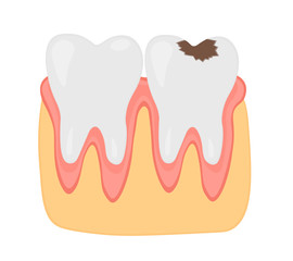 Healthy and unhealthy teeth dental treatment stomatology vector illustration.
