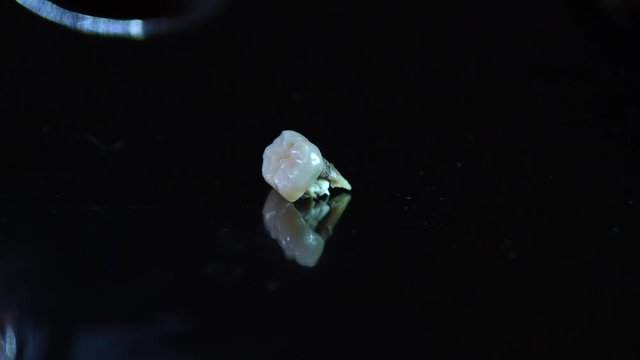 False Teeth pulled out. Extracted broken metal with bits of real tooth removed. Close up isolated.