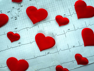 An electrocardiogram and hearts of different sizes are located diagonally on a horizontal...