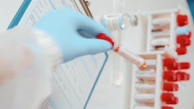 Vertical footage of laboratory technician holds in one hand laboratory positive blood test tube for cancer prostate and writing down results to patients medical record. Laboratory medical diagnostics
