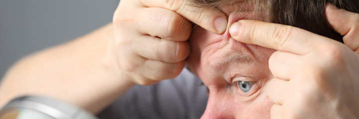 Close-up of middle-aged male person squeezing pimple on forehead looking in table mirror. Problematic facial skin with acne. Beauty hygiene and skin problem