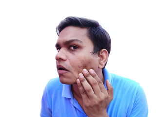 Young man having pimples checking marks on face