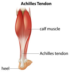 Medical infographic of achilles tendon - obrazy, fototapety, plakaty
