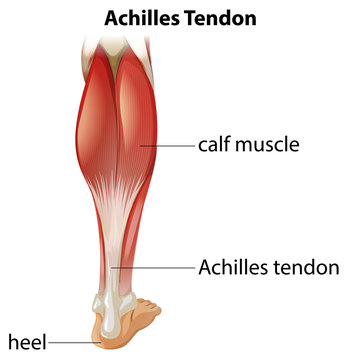 Medical infographic of achilles tendon