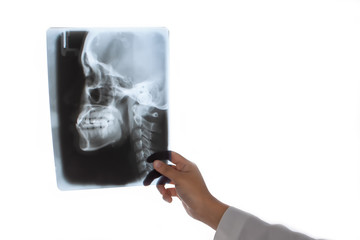 Dentist holding dental X-Ray film isolated on white background.