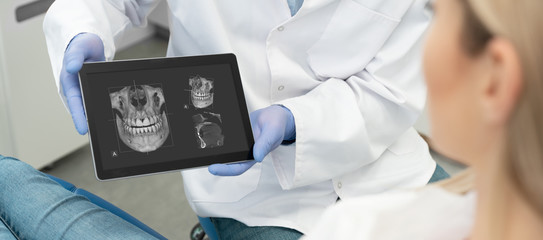 Dentist showing teeth x-ray on tablet screen