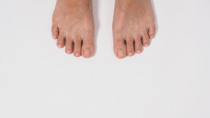Foot peeling or remove dead skin on white background.