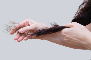 Hair loss. Close-up of  woman with brown hairs in her hand.