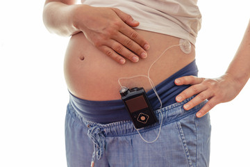 Pregnant woman with insuline pump on her pants and drainage mounted on her belly. Modern diabetes...