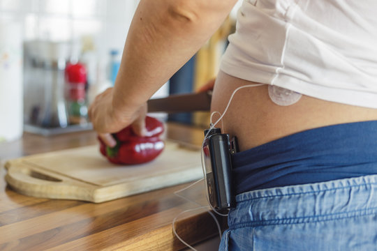 Pregnant woman with insuline pump on her pants and drainage mounted on her belly in kitchen preparing healthy food. Modern diabetes treatment.
