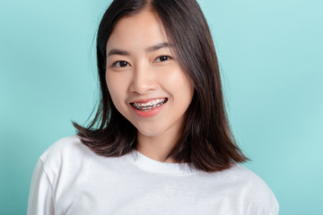 Dental braces of young asian woman wearing braces with white teeth concept.